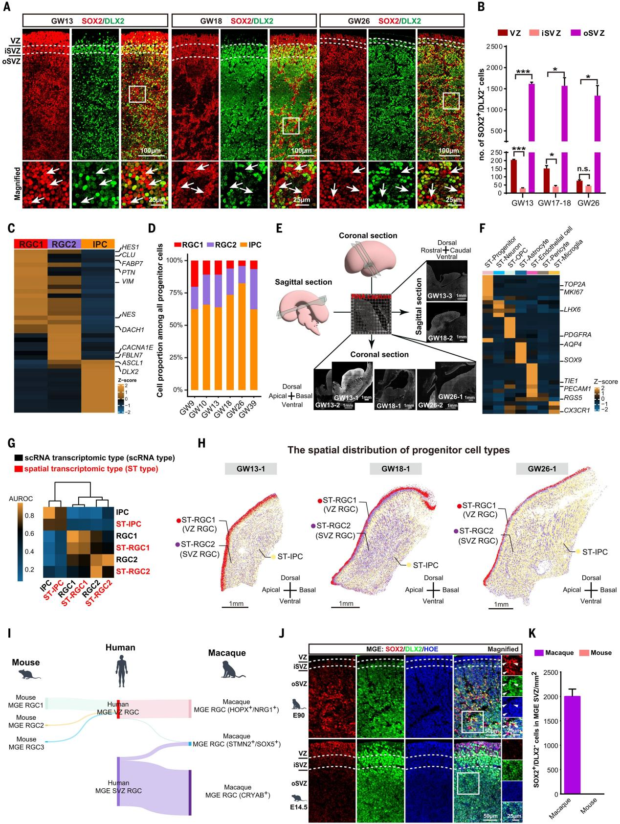 图1. 人类内侧神经节隆起脑室下区中的一种进化上独特的祖细胞类型(SVZ RGC)